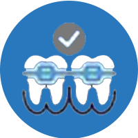 best braces treatment in hinjwadi pune